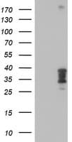 HOXC11 Antibody (clone OTI1F8)