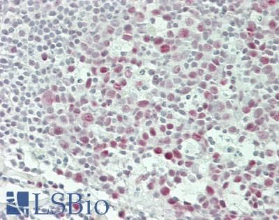 IHC-plus™ DDX5 Antibody (aa575-C-term)