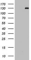 PR / Progesterone Receptor Antibody (aa1-298, clone OTI7A9)