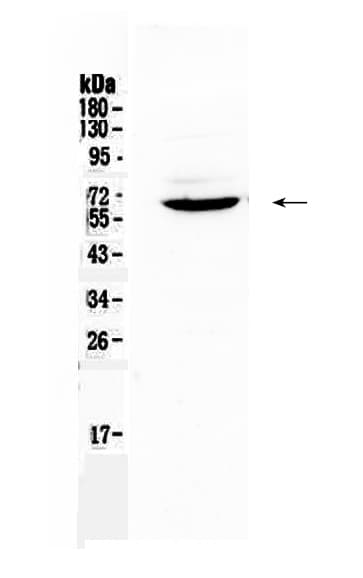 Polyclonal Rabbit anti-Mouse HPSE / Heparanase Antibody (WB)
