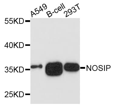 NOSIP Antibody