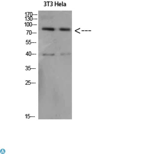 APP / Beta Amyloid Precursor Antibody