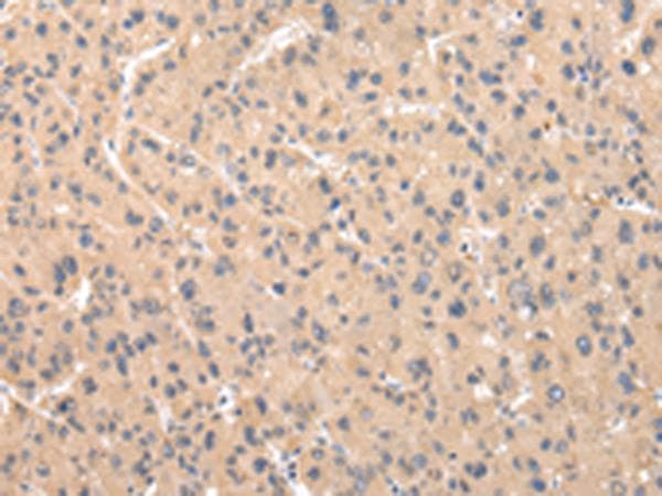 Polyclonal Rabbit anti-Human ZNF268 Antibody (IHC)