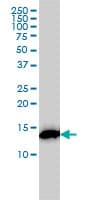 RPS19 / Ribosomal Protein S19 Antibody (clone 3C6)