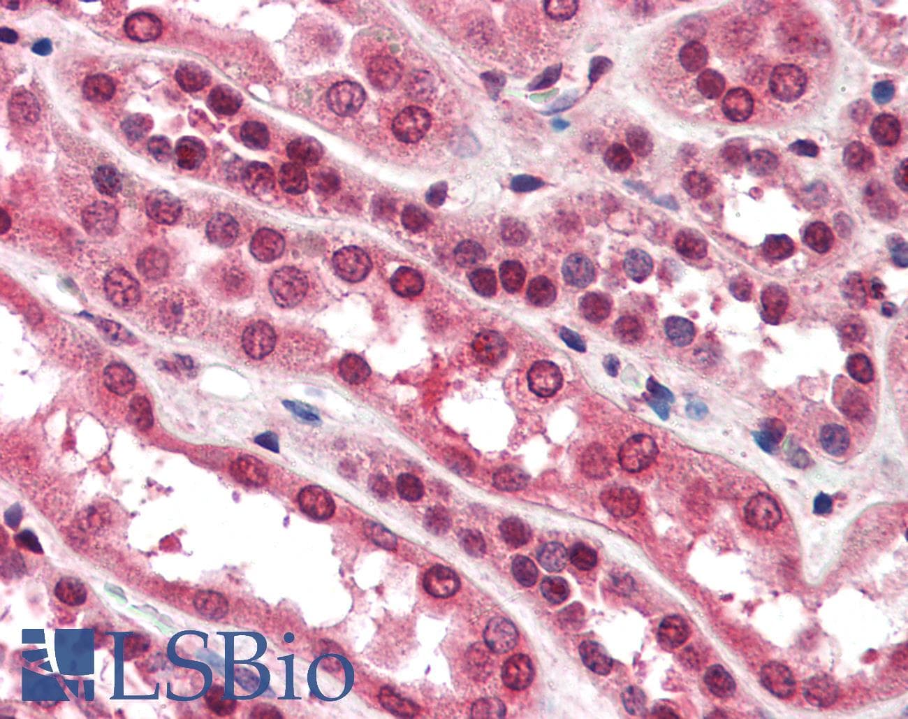 IHC-plus™ ZNF292 Antibody