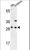 Polyclonal Rabbit anti-Human GCLM Antibody (aa246-274, IHC, IF, WB)