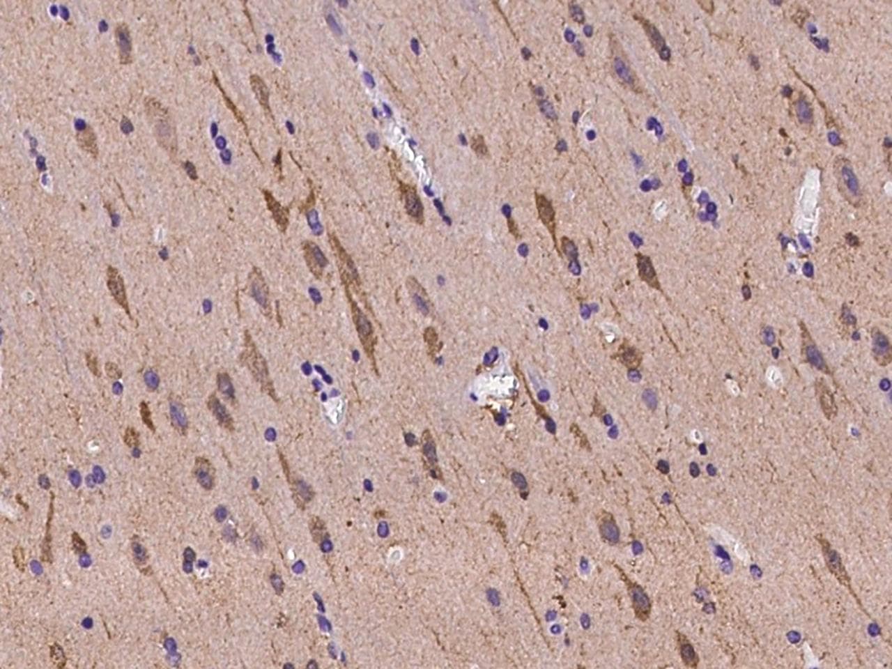 PDE1B Antibody