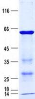 Human HMBOX1 Protein (Recombinant His, N-Terminal)