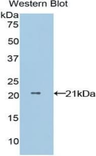 NME1 / NM23 Antibody (aa1-152)