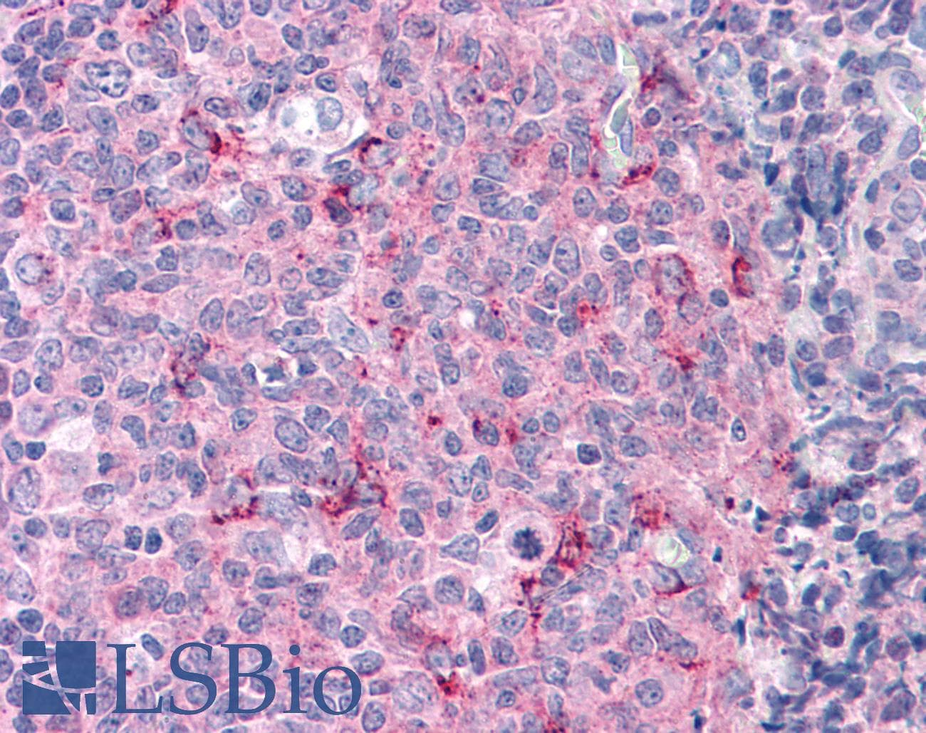 IHC-plus™ CASP3 / Caspase 3 Antibody