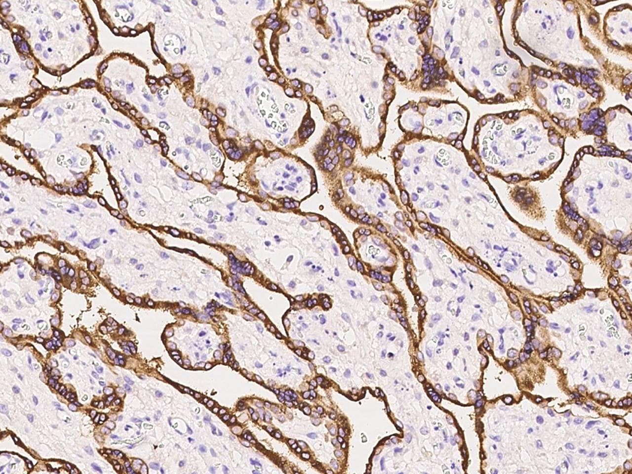 GH / Growth Hormone Antibody (Preservative Free)