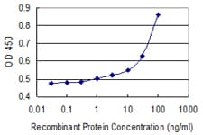 A2M / Alpha-2-Macroglobulin Antibody (clone 2B5)