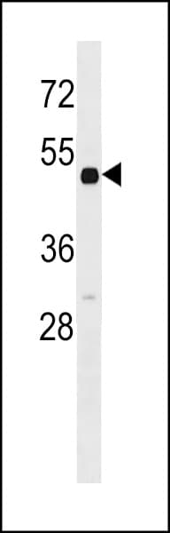 RARB / RAR Beta Antibody (aa3-31)
