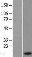 SAA1 / SAA / Serum Amyloid A Protein (Over-Expression Lysate Myc-DDK (Flag))