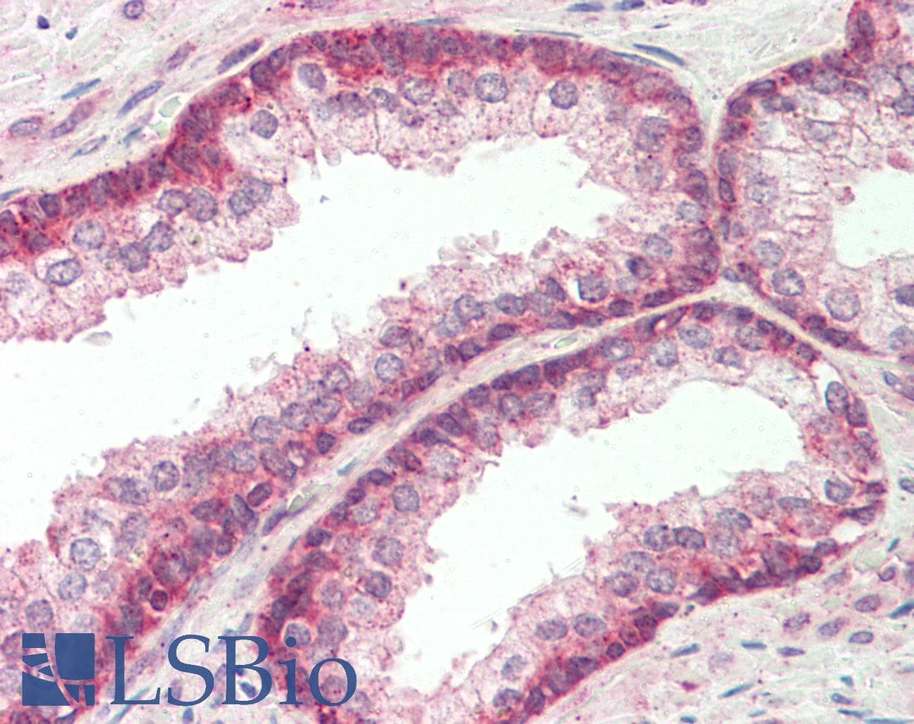 FBXO21 Antibody (aa74-123)