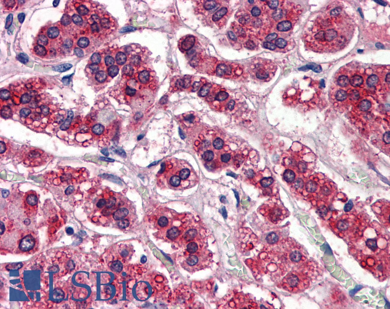PathPlus™ APOE / Apolipoprotein E Antibody