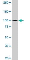 MYBL1 / A-MYB Antibody (clone 2A2)