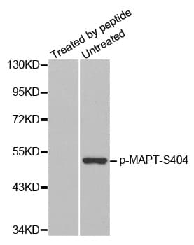 MAPT / Tau Antibody (phospho-Ser404)