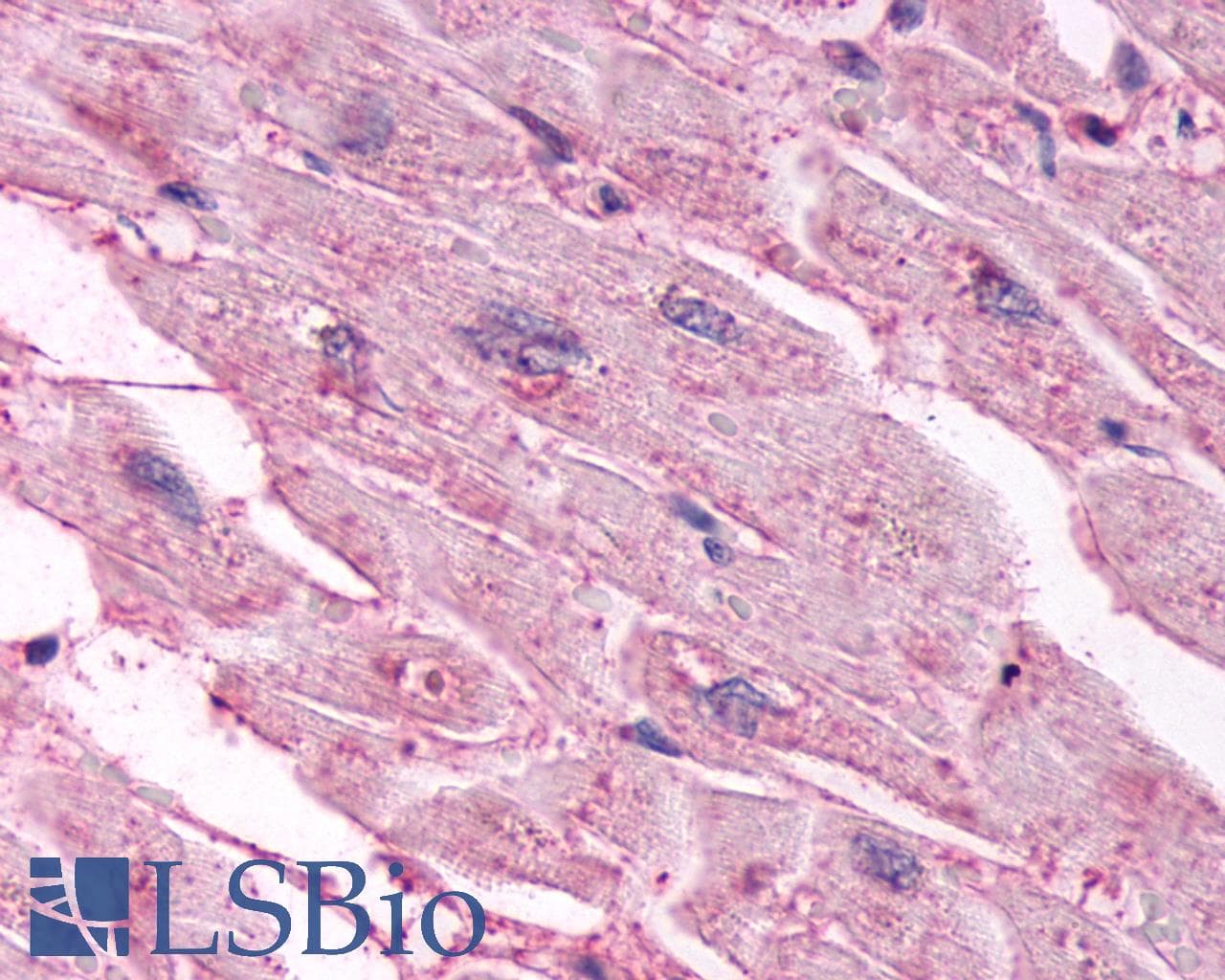 PathPlus™ CHRM3 / M3 Antibody (C-Terminus)