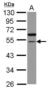 CDCA7L Antibody
