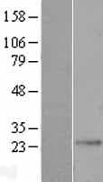 DYNC2LI1 / D2LIC Protein (Over-Expression Lysate Myc-DDK (Flag))