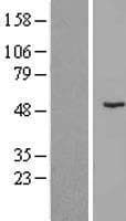 ZNF621 Protein (Over-Expression Lysate Myc-DDK (Flag))