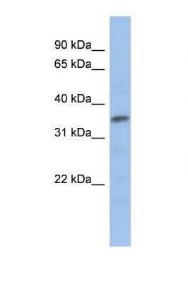 Polyclonal Rabbit anti-Human MYF5 / MYF 5 Antibody (aa71-120, WB)