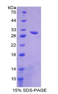 Mouse ABCB11 / BSEP Protein (Recombinant His-T7)