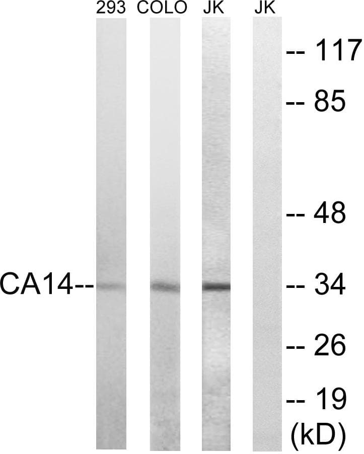 CA14 / Carbonic Anhydrase XIV Antibody