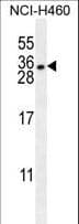 Polyclonal Rabbit anti-Human HLA-DQA1 Antibody (aa39-66, WB)