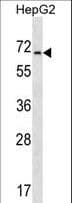 ACCN4 / ASIC4 Antibody (aa23-52)