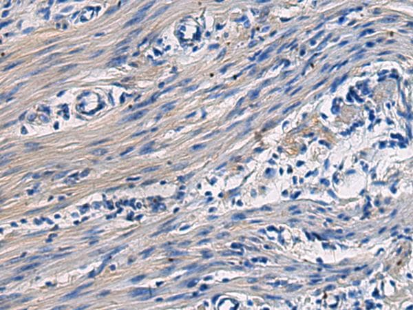 COL17A1 / Collagen XVII Antibody