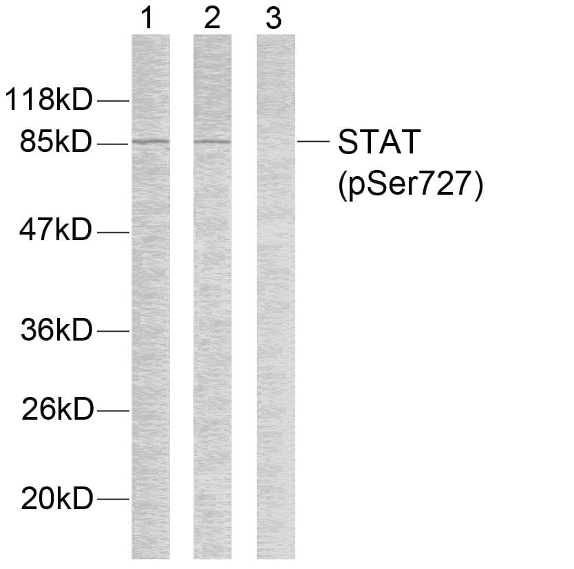 STAT3 Antibody (phospho-Ser727)