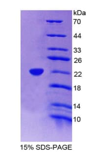 Human CD177 Protein (Recombinant His-T7)