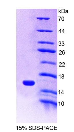 Mouse MIA / CD-RAP Protein (Recombinant His-T7)
