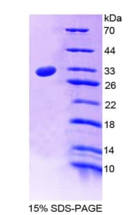Rat LDLR / LDL Receptor Protein (Recombinant His-T7)