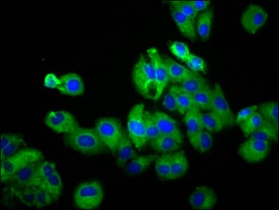 Polyclonal Rabbit anti-Human UGT2B7 Antibody (IHC, IF)