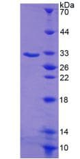 Mouse SGK1 / SGK Protein (Recombinant His-T7)