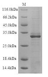 Lymphocytic Choriomeningitis Virus GPC Protein (Recombinant 6His-SUMO, N-terminus)