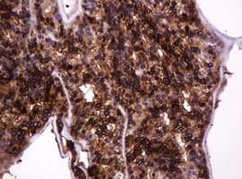 EMA / MUC1 Antibody (clone OTI2E3)
