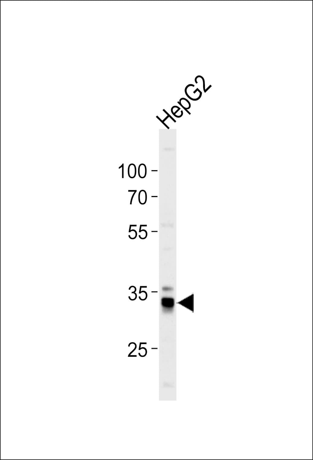Polyclonal Rabbit anti-Human MPST Antibody (aa24-53, WB)