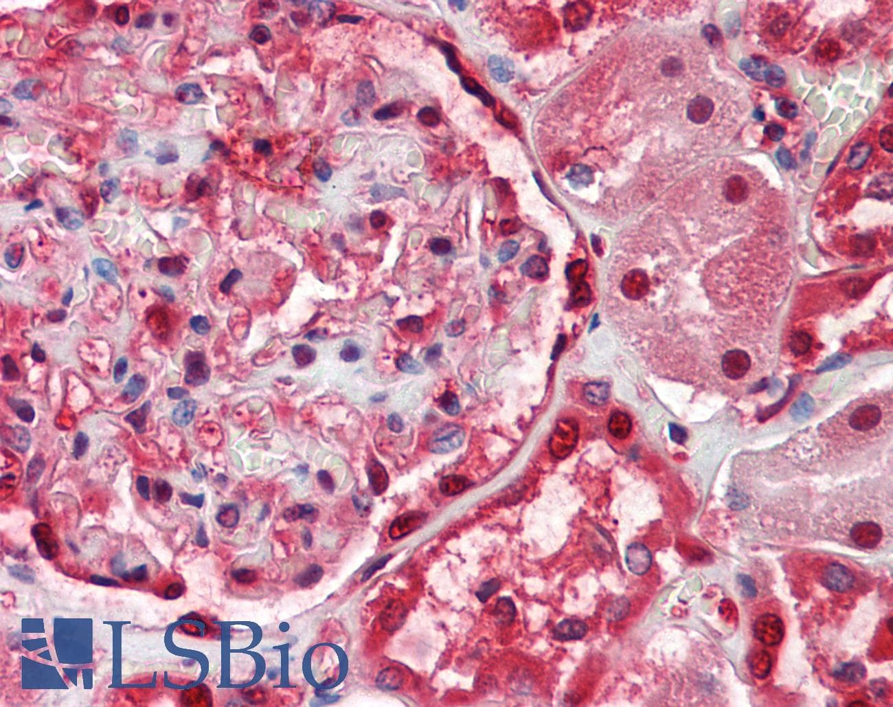 IHC-plus™ PSAP / Prosaposin Antibody (clone 4D5F4)