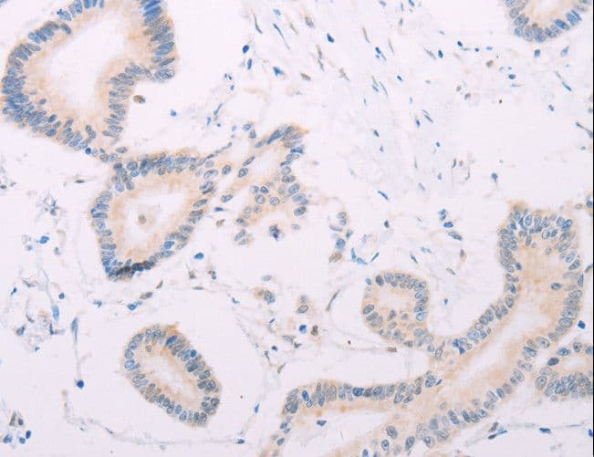 Polyclonal Rabbit anti-Human MAP3K12 Antibody (IHC)