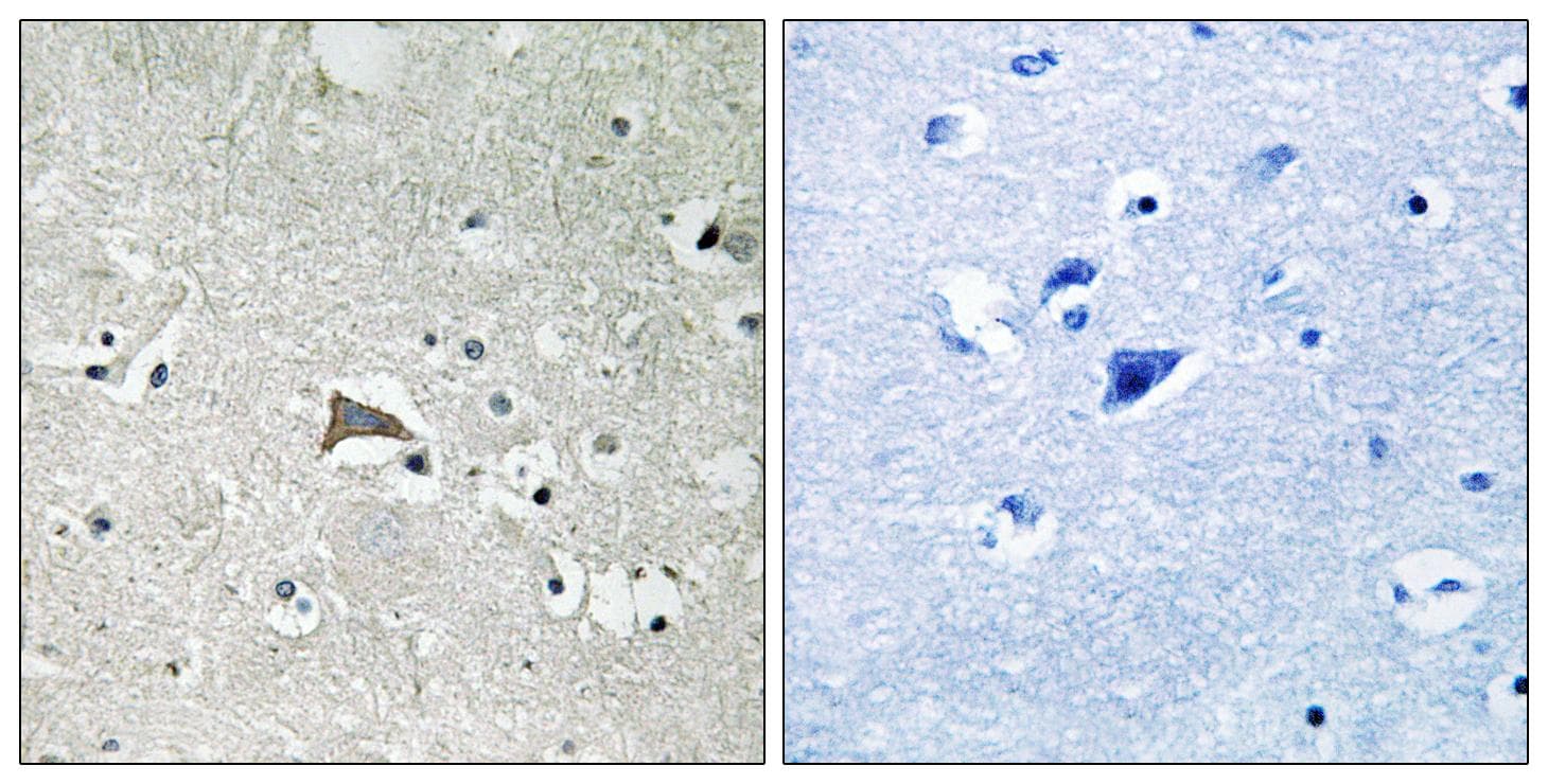 Polyclonal Rabbit anti-Human FLT1 / VEGFR1 Antibody (Ab-1048, IHC)
