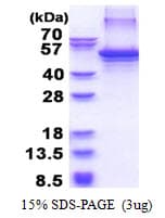 Human CLU / Clusterin Protein (Recombinant His)