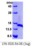 E. coli dsbE Protein (Recombinant)