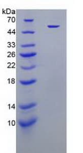 Human HNE / Neutrophil Elastase Protein (Recombinant His-GST)