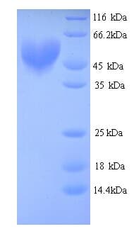 Human ARNT / HIF-1-Beta Protein (Recombinant 6His, N-terminus)