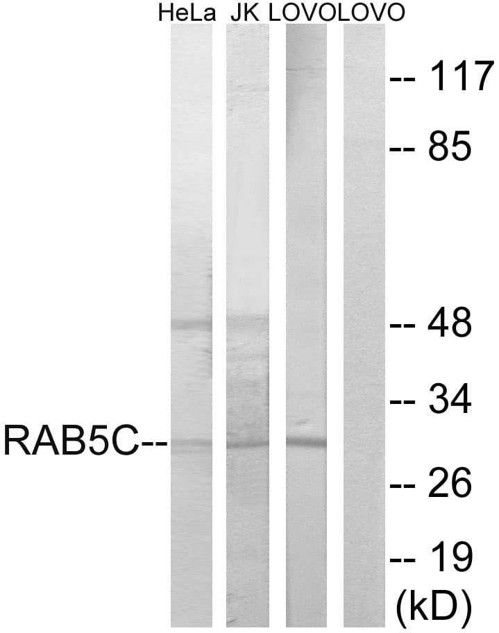 RAB5C Antibody (aa122-171)