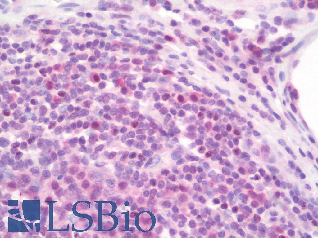 IHC-plus™ BCL3 / BCL-3 Antibody